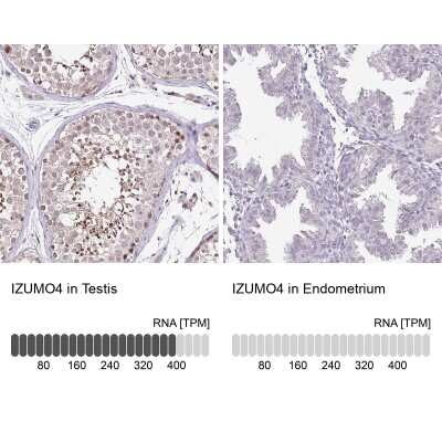Immunohistochemistry-Paraffin: IZUMO4 Antibody [NBP2-30881]