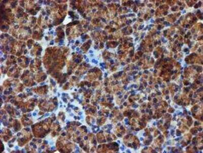 Immunohistochemistry-Paraffin: Iduronate 2-Sulfatase/IDS Antibody (OTI1D9) [NBP2-01745]