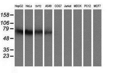 Western Blot: Iduronate 2-Sulfatase/IDS Antibody (OTI1D9) [NBP2-01745]
