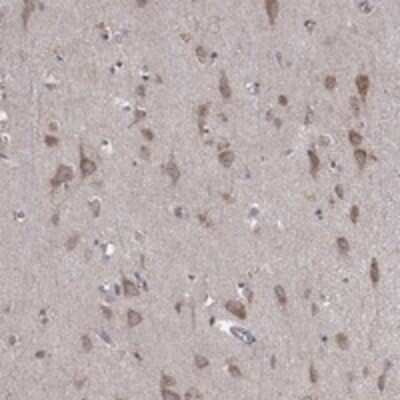 Immunohistochemistry-Paraffin: Iduronate 2-Sulfatase/IDS Antibody [NBP3-17659]