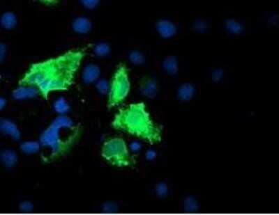 Immunocytochemistry/ Immunofluorescence: Iduronate 2-Sulfatase/IDS Antibody (OTI1D9) - Azide and BSA Free [NBP2-70994]