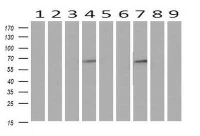 Western Blot: Iduronate 2-Sulfatase/IDS Antibody (OTI1D9) [NBP2-01745]
