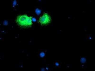 Immunocytochemistry/ Immunofluorescence: Iduronate 2-Sulfatase/IDS Antibody (OTI4G2) - Azide and BSA Free [NBP2-70996]