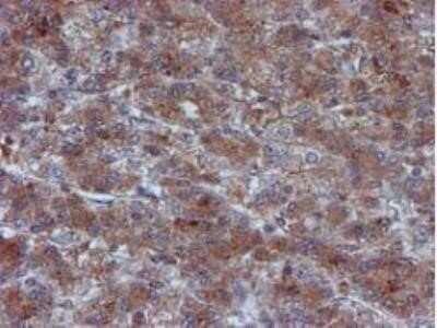 Immunohistochemistry: Iduronate 2-Sulfatase/IDS Antibody (OTI4G2) - Azide and BSA Free [NBP2-70996]