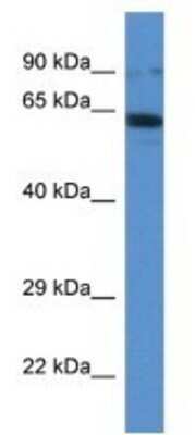 Western Blot: Ift80 Antibody [NBP1-74179]
