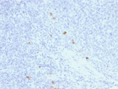 Immunohistochemistry-Paraffin: Ig gamma-4 Chain C Region Antibody (rIGHG4/1345) [NBP3-07432]
