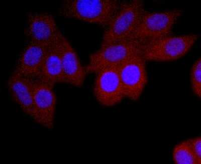 Immunocytochemistry/ Immunofluorescence: IgA Antibody (JM10-42) [NBP2-66901]