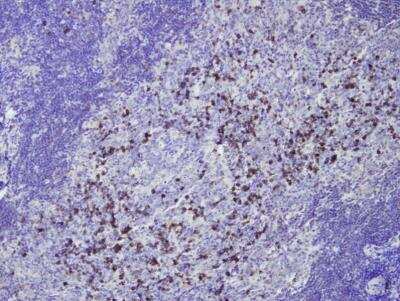 Immunohistochemistry-Paraffin: IgG Antibody (E20-V) [NBP3-08196]