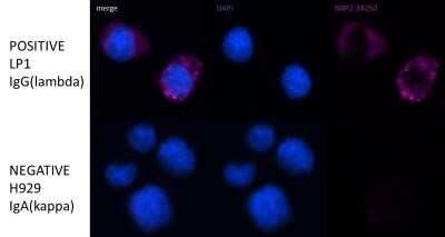 Immunocytochemistry/ Immunofluorescence: IgG Antibody (IG266) - Azide and BSA Free [NBP2-34648]