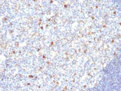 Immunohistochemistry-Paraffin: IgM Antibody (SPM188) - IHC-Prediluted [NBP2-48240]