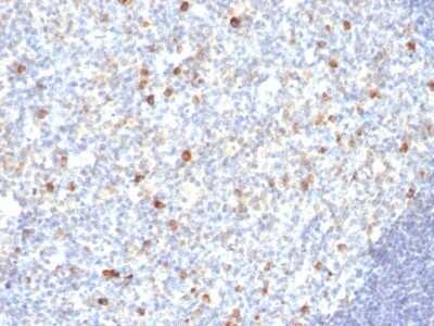 Immunohistochemistry-Paraffin: IgM Antibody (SPM188) [NBP2-45055]