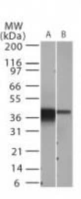 Western Blot: IkB-alpha Antibody (6A920)BSA Free [NB100-56507]