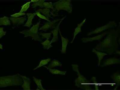 Immunocytochemistry/ Immunofluorescence: IkB-beta Antibody (1G6) [H00004793-M06]