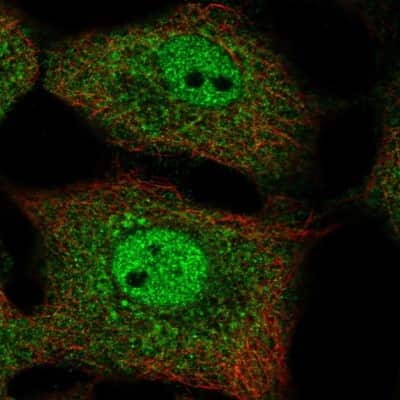 Immunocytochemistry/ Immunofluorescence: IkB-beta Antibody [NBP2-57108]