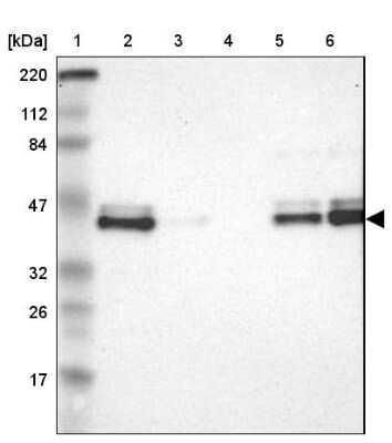 Western Blot: IkB-epsilon Antibody [NBP1-87762]