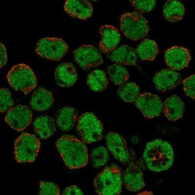Immunocytochemistry/ Immunofluorescence: Ikaros/IKZF1 Antibody [NBP2-38241]