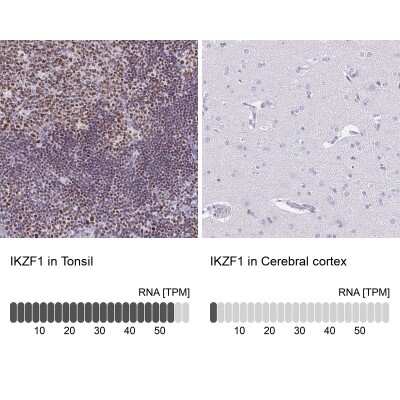 Immunohistochemistry-Paraffin: Ikaros/IKZF1 Antibody [NBP2-38241]