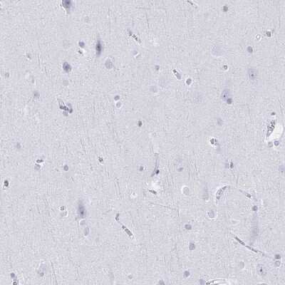 Immunohistochemistry-Paraffin: Ikaros/IKZF1 Antibody [NBP2-38242]