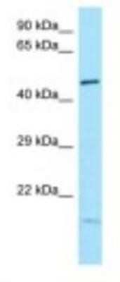 Western Blot: Ikaros/IKZF1 Antibody [NBP1-98314]