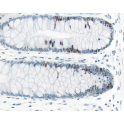 Immunohistochemistry: ImmPRESS(TM) Excel Amplified anti-Rabbit IgG HRP Polymer Staining Kit (Colorimetric) [MP-7601-NB]