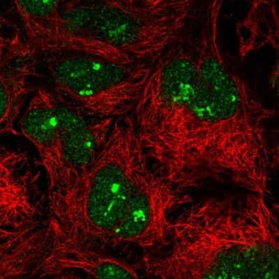 Immunocytochemistry/ Immunofluorescence: Importin 11 Antibody [NBP2-49505]