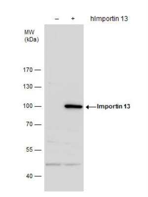 Western Blot: Importin-13 Antibody [NBP2-14994]