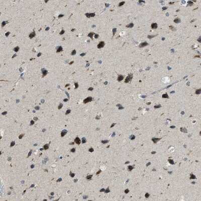Immunohistochemistry-Paraffin: Importin-7 Antibody [NBP1-87880]