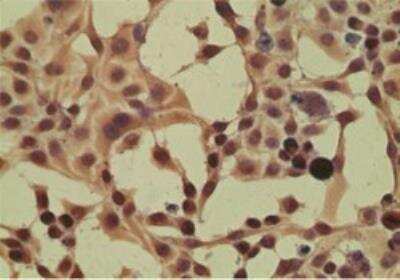 Immunocytochemistry/ Immunofluorescence: Importin-8 Antibody [NBP2-24751]