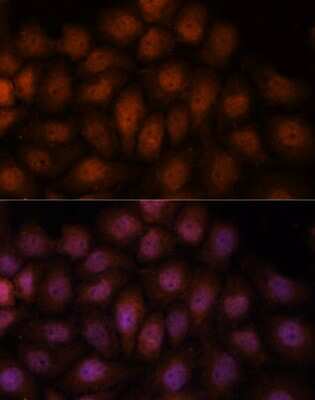 Immunocytochemistry/ Immunofluorescence: Importin-8 Antibody - Azide and BSA Free [NBP3-03821]