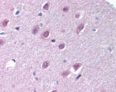 Immunohistochemistry-Paraffin: Importin-9 Antibody [NB100-56489]