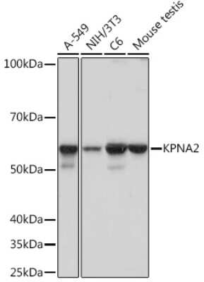 Western Blot: Importin alpha 2/KPNA2 Antibody (9T3V8) [NBP3-16530]