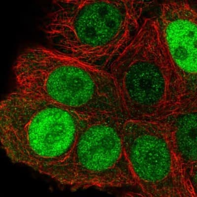 Immunocytochemistry/ Immunofluorescence: Importin alpha 2/KPNA2 Antibody [NBP2-38482]