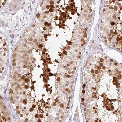 Immunohistochemistry: Importin alpha 2/KPNA2 Antibody [NBP2-38482]