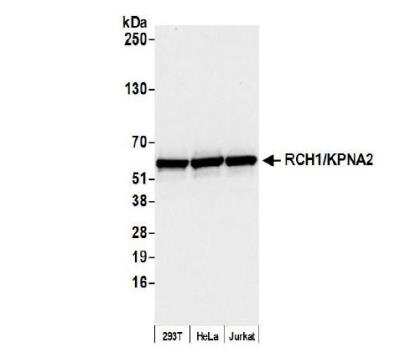 Western Blot: Importin alpha 2/KPNA2 Antibody [NB100-79808]