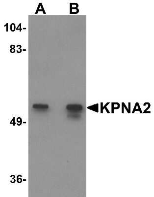 Western Blot: Importin alpha 2/KPNA2 AntibodyBSA Free [NBP1-76298]