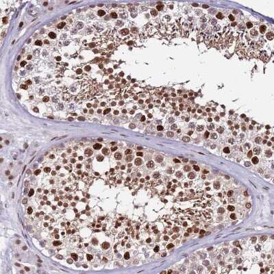 Immunohistochemistry-Paraffin: Importin alpha 3/KPNA4 Antibody [NBP2-38541]