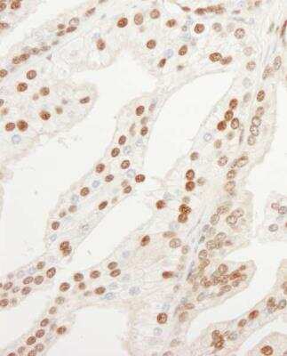 Immunohistochemistry-Paraffin: Importin alpha 3/KPNA4 Antibody [NB100-81651]