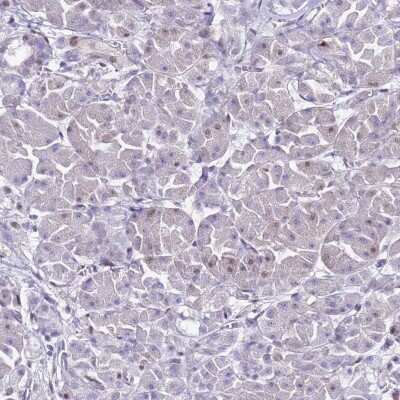 Immunohistochemistry-Paraffin: Importin alpha 3/KPNA4 Antibody [NBP2-14173]