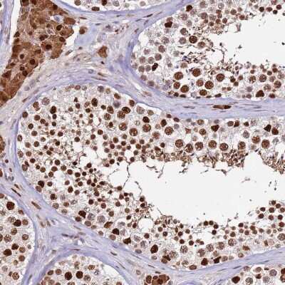 Immunohistochemistry-Paraffin: Importin alpha 3/KPNA4 Antibody [NBP2-14173]