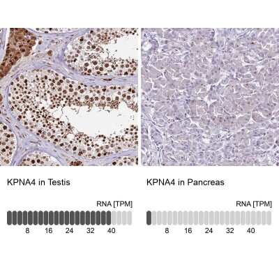 Immunohistochemistry-Paraffin: Importin alpha 3/KPNA4 Antibody [NBP2-14173]