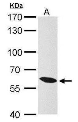 Western Blot: Importin alpha 3/KPNA4 Antibody [NBP1-31260]