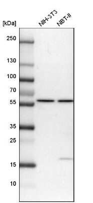 Western Blot: Importin alpha 3/KPNA4 Antibody [NBP2-14173]
