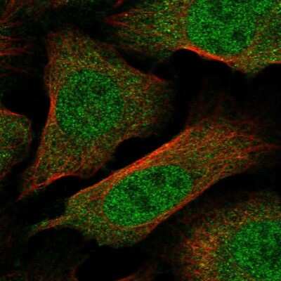 Immunocytochemistry/ Immunofluorescence: Importin alpha 5/KPNA1/SRP1 Antibody [NBP2-47418]