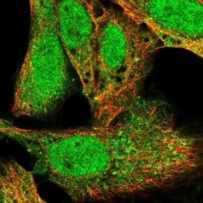 Immunocytochemistry/ Immunofluorescence: Importin alpha 5/KPNA1/SRP1 Antibody [NBP2-56022]