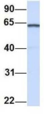 Western Blot: Importin alpha 5/KPNA1/SRP1 Antibody [NBP1-54604]