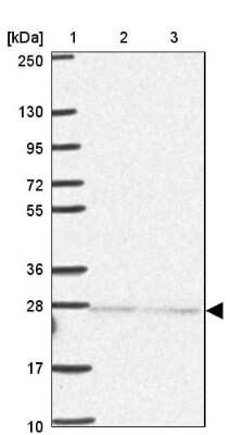 Western Blot: Importin alpha 5/KPNA1/SRP1 Antibody [NBP2-47418]