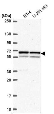 Western Blot: Importin alpha 5/KPNA1/SRP1 Antibody [NBP2-56022]
