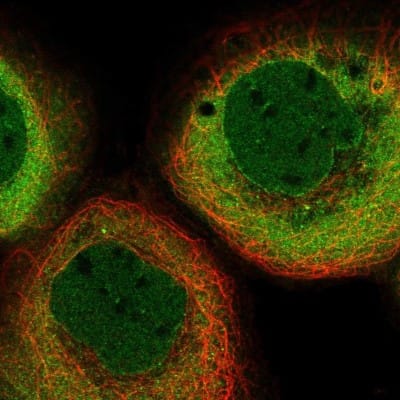 Immunocytochemistry/ Immunofluorescence: Importin beta/KPNB1 Antibody [NBP1-87712]