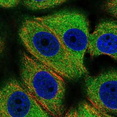 Immunocytochemistry/ Immunofluorescence: Importin4 Antibody [NBP2-56986]
