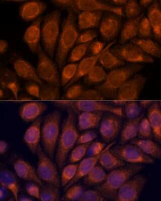 Immunocytochemistry/ Immunofluorescence: Importin4 Antibody - Azide and BSA Free [NBP3-03794]
